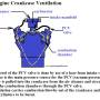 v-8_engine_breather_system_by_hippysmack.jpg